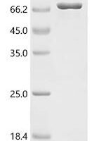 Human Neuronal acetylcholine receptor subunit alpha-3 (CHRNA3), partial, Biotinylated Recombinant Protein - BioCrest Sci