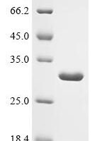 Escherichia coli Intermembrane phospholipid transport system binding protein MlaC (mlaC) Recombinant Protein, C-His - BioCrest Sci