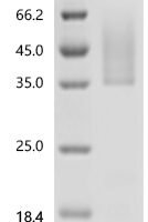 Rat Tonin (Klk2) Recombinant Protein, C-His, aa 25–259, Yeast - BioCrest Sci