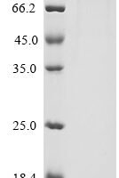 Human Dipeptidyl peptidase 4 (DPP4), partial Recombinant Protein, N-hFc1-Flag/C-Myc - BioCrest Sci