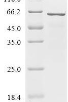 Escherichia coli Glutamate--tRNA ligase (gltX) Recombinant Protein - BioCrest Sci