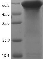 Human Keratin, type II cytoskeletal 7 (KRT7) Recombinant Protein - BioCrest Sci