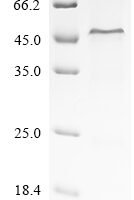 Human Complement factor H (CFH), partial Recombinant Protein, N-His - BioCrest Sci