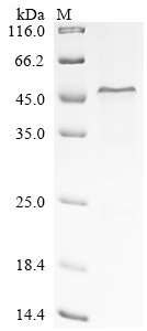 Human Complement factor H (CFH), partial Recombinant Protein, N-His, Homo sapiens (Human), E.coli, N-terminal 6xHis-tagged, 50.5 kDa, purity >≥ 85% as determined by SDS-PAGE.
