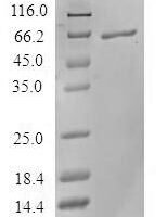 Human Serine-threonine kinase receptor-associated protein (STRAP) Recombinant Protein - BioCrest Sci