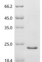 Human Solute carrier family 22 member 4 (SLC22A4), partial Recombinant Protein - BioCrest Sci