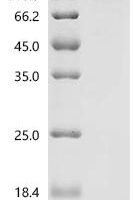 Mouse Protein Wnt-9a (Wnt9a) Recombinant Protein, C-10His-HSA - BioCrest Sci