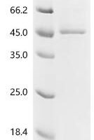Human Procollagen C-endopeptidase enhancer 2 (PCOLCE2) Recombinant Protein - BioCrest Sci