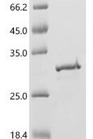 Epstein-Barr virus Capsid scaffolding protein, partial Recombinant Protein - BioCrest Sci