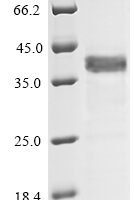 Human Complement component C9 (C9), partial Recombinant Protein, N-His-GST - BioCrest Sci