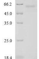 Human RNA-binding protein PNO1 (PNO1) Recombinant Protein, C-hFc1 - BioCrest Sci