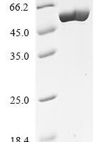 Clostridium tetani Tetanus toxin, partial Recombinant Protein, C-His, aa 866–1310+EGWIN - BioCrest Sci