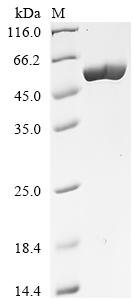 Clostridium tetani Tetanus toxin, partial Recombinant Protein, C-His, aa 866–1310+EGWIN, Clostridium tetani, E.coli, C-terminal 6xHis-tagged, 58.6 kDa, purity >≥ 85% as determined by SDS-PAGE.