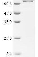 Human Adipocyte plasma membrane-associated protein (APMAP), partial Recombinant Protein, C-hFc1 - BioCrest Sci