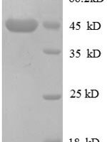 Human Cation-independent mannose-6-phosphate receptor (IGF2R), partial Recombinant Protein, N-GST - BioCrest Sci