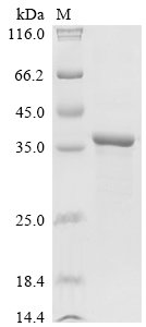 Shigella flexneri Outer membrane protease icsP (icsP) Recombinant Protein, Shigella flexneri, E.coli, N-terminal 6xHis-tagged, 37.4 kDa, purity >≥ 90% as determined by SDS-PAGE.