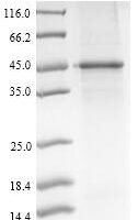 Mouse Pyruvate dehydrogenase E1 component subunit alpha, somatic form, mitochondrial (Pdha1) Recombinant Protein - BioCrest Sci