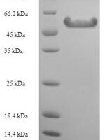 Ambrosia artemisiifolia Pectate lyase 5 Recombinant Protein, N-His-SUMO - BioCrest Sci