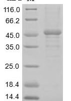 Rat Heat-stable enterotoxin receptor (Gucy2c), partial Recombinant Protein, N-10His/C-Myc - BioCrest Sci