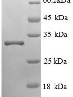 Human Lipopolysaccharide-responsive and beige-like anchor protein (LRBA), partial Recombinant Protein, N-His, aa 1–251 - BioCrest Sci