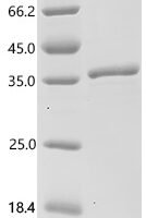 Human T-cell surface glycoprotein CD1c (CD1C), partial Recombinant Protein, C-His - BioCrest Sci