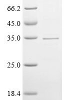 Human Protein GAPT (GAPT), partial Recombinant Protein - BioCrest Sci