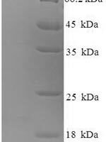 Rabbit Melanotransferrin (Mfi2), partial Recombinant Protein - BioCrest Sci