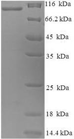Rabbit Melanotransferrin (Mfi2), partial Recombinant Protein, Oryctolagus cuniculus (Rabbit), E.coli, N-terminal 6xHis-SUMO-tagged, 91.7 kDa, purity >≥ 90% as determined by SDS-PAGE.