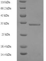Human Ubiquitin D (UBD) Recombinant Protein - BioCrest Sci