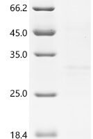 Human Surfactant-associated protein 2 (SFTA2) Recombinant Protein, C-His - BioCrest Sci