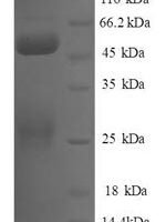 Human Negative elongation factor B (NELFB), partial Recombinant Protein - BioCrest Sci