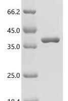 Escherichia coli Aminoglycoside (3'') (9) adenylyltransferase (aadA) Recombinant Protein, N-10His/C-Myc - BioCrest Sci