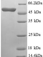 Mouse Asialoglycoprotein receptor 1 (Asgr1), partial Recombinant Protein - BioCrest Sci