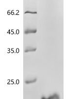 Human MHC class I polypeptide-related sequence B (MICB), partial Recombinant Protein, C-His, aa 204–297 - BioCrest Sci