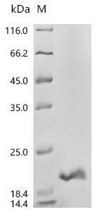 Human MHC class I polypeptide-related sequence B (MICB), partial Recombinant Protein, C-His, aa 204–297, Homo sapiens (Human), E.coli, C-terminal 6xHis-tagged, 17.4 kDa, purity >≥ 95% as determined by SDS-PAGE.