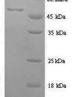 Human Methionine aminopeptidase 2 (METAP2) Recombinant Protein, N-His - BioCrest Sci