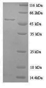 Human Methionine aminopeptidase 2 (METAP2) Recombinant Protein, N-His, Homo sapiens (Human), Yeast, N-terminal 6xHis-tagged, 54.8 kDa, purity >≥ 90% as determined by SDS-PAGE.