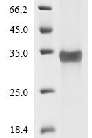 Human Zinc finger protein GLI1 (GLI1), partial Recombinant Protein, N-His/C-His - BioCrest Sci