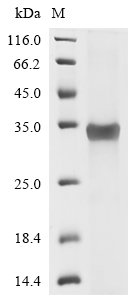 Human Zinc finger protein GLI1 (GLI1), partial Recombinant Protein, N-His/C-His, Homo sapiens (Human), E.coli, N-terminal 6xHis-tagged and C-terminal 6xHis-tagged, 28.3 kDa, purity >≥ 85% as determined by SDS-PAGE.