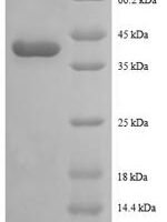 Human Tax1-binding protein 3 (TAX1BP3) Recombinant Protein - BioCrest Sci