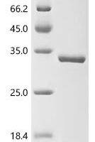 Schizosaccharomyces pombe Alpha N-terminal protein methyltransferase 1 (tae1) Recombinant Protein - BioCrest Sci