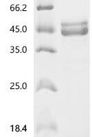 Enterobacteria phage T4 Highly immunogenic outer capsid protein (hoc) Recombinant Protein - BioCrest Sci