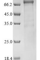 Human ATP-dependent RNA helicase DDX3Y (DDX3Y) Recombinant Protein - BioCrest Sci