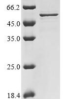 Human SARS coronavirus Nucleoprotein (N) Recombinant Protein - BioCrest Sci
