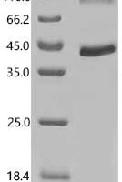 Human Protein Wnt-5a (WNT5A) Recombinant Protein, C-His - BioCrest Sci
