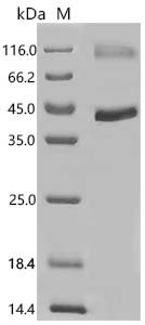 Human Protein Wnt-5a (WNT5A) Recombinant Protein, C-His, Homo sapiens (Human), E.coli, C-terminal 6xHis-tagged, 42.7 kDa, purity >≥ 85% as determined by SDS-PAGE.