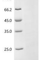 Human Sodium- and chloride-dependent neutral and basic amino acid transporter B (0+) (SLC6A14), partial Recombinant Protein - BioCrest Sci