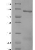 Human Retinaldehyde dehydrogenase 3 (ALDH1A3) Recombinant Protein, N-His - BioCrest Sci