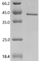 Human AKT-interacting protein(AKTIP) Recombinant Protein - BioCrest Sci