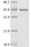 Human Induced myeloid leukemia cell differentiation protein Mcl-1(MCL1), partial Recombinant Protein - BioCrest Sci